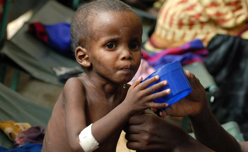 India malnutrition