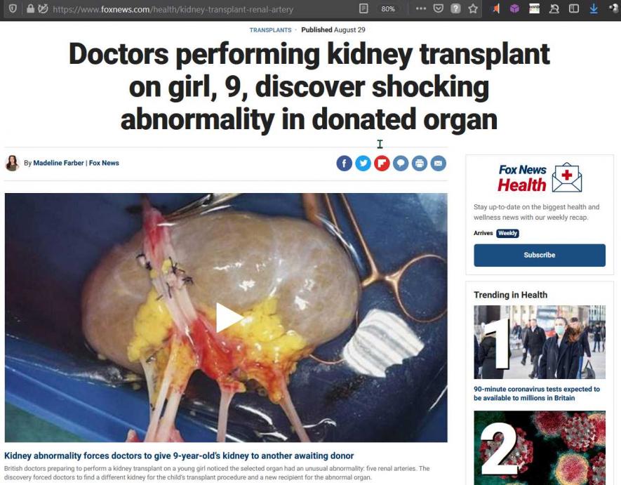 Delhi Doctor Arrest Kidney Racket photo viral with false COVID-19 angle